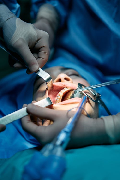 Cirurgia Bucal