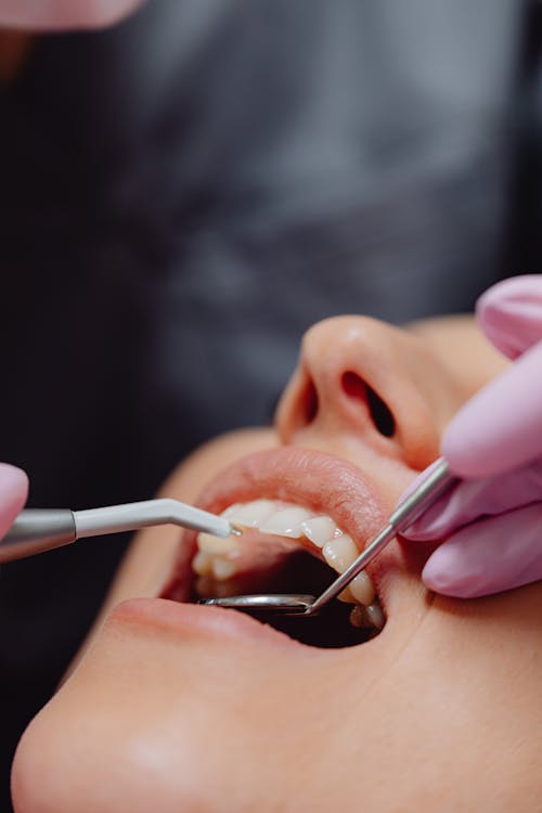 Periodontia e Gengiva
